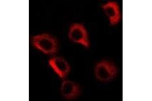 Image no. 1 for anti-Golgi Membrane Protein 1 (GOLM1) (full length) antibody (ABIN6004426)