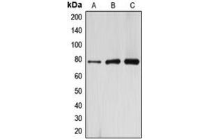 Western blot analysis of ARHGAP22 expression in HeLa (A), mouse kidney (B), rat kidney (C) whole cell lysates.