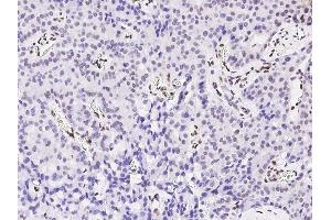 Image no. 3 for anti-Promyelocytic Leukemia (PML) (N-Term) antibody (ABIN6924426)