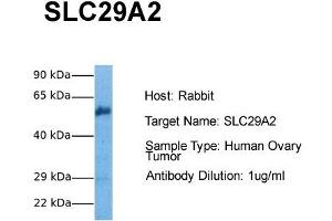 Image no. 1 for anti-Solute Carrier Family 29 (Nucleoside Transporters), Member 2 (SLC29A2) (C-Term) antibody (ABIN2781572)