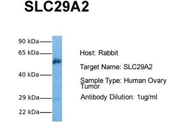 SLC29A2 抗体  (C-Term)