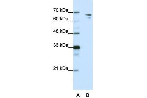 Image no. 1 for anti-Splicing Factor 1 (SF1) (N-Term) antibody (ABIN2776691)