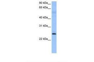 Image no. 1 for anti-Rhophilin Associated Tail Protein 1 (ROPN1) (AA 39-88) antibody (ABIN6738784)
