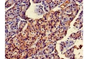 Immunohistochemistry of paraffin-embedded human pancreatic tissue using ABIN7170725 at dilution of 1:100
