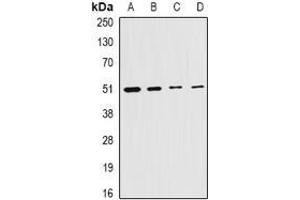Image no. 1 for anti-Citrate Synthase (CS) (full length) antibody (ABIN6005220)