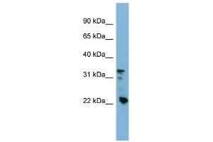 Image no. 1 for anti-Crystallin, beta B3 (CRYbB3) (Middle Region) antibody (ABIN631403)