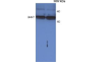 Image no. 1 for anti-serine Hydroxymethyltransferase 1 (Soluble) (SHMT1) antibody (ABIN5706931)