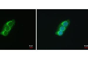 ICC/IF Image SEC13L1 antibody [N1C3] detects SEC13L1 protein at COP II vesicles by immunofluorescent analysis.
