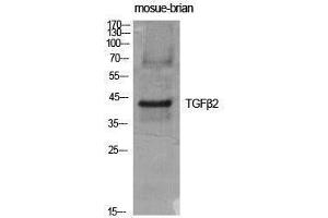 Image no. 1 for anti-Transforming Growth Factor, beta 2 (TGFB2) (C-Term) antibody (ABIN3187250)