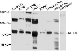 Image no. 1 for anti-Kelch-Like 9 (KLHL9) antibody (ABIN6566794)