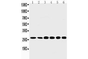 Image no. 1 for anti-Sonic Hedgehog (SHH) (AA 203-218), (N-Term) antibody (ABIN3043230)