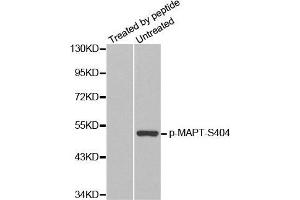 Image no. 2 for anti-Microtubule-Associated Protein tau (MAPT) (pSer404) antibody (ABIN3019704)