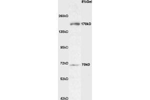 Image no. 2 for anti-Roundabout, Axon Guidance Receptor, Homolog 4 (ROBO4) (AA 261-360) antibody (ABIN714866)