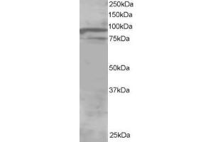 Image no. 1 for anti-Oxysterol Binding Protein-Like 11 (OSBPL11) (C-Term) antibody (ABIN185121)