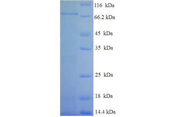 TEKT5 Protein (AA 1-485, full length) (His-SUMO Tag)