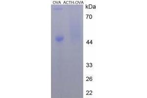 Image no. 2 for Adrenocorticotropic hormone (ACTH) peptide (Ovalbumin) (ABIN5666063)