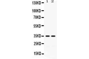 Image no. 3 for anti-CD58 (CD58) (AA 29-215) antibody (ABIN4886530)