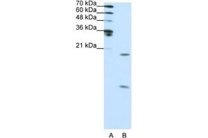 Image no. 1 for anti-Small Nuclear Ribonucleoprotein Polypeptide F (SNRPF) antibody (ABIN2462139)