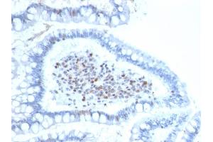 Image no. 4 for anti-BMI1 Polycomb Ring Finger Oncogene (BMI1) (AA 142-326) antibody (ABIN6940580)