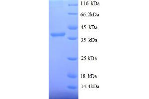 Image no. 1 for Signal Recognition Particle 14kDa (Homologous Alu RNA Binding Protein) (SRP14) (AA 2-108), (partial) protein (GST tag) (ABIN5712261)