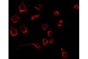 PLAGL1 anticorps  (Internal Region)