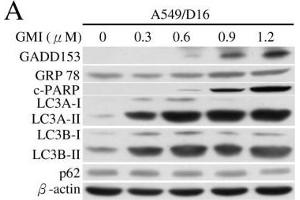 Image no. 10 for anti-Sequestosome 1 (SQSTM1) (Internal Region) antibody (ABIN2854836)
