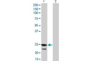 anti-Regulator of G-Protein Signaling 4 (RGS4) (AA 1-205) antibody