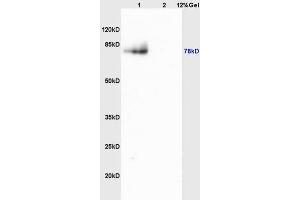 Image no. 2 for anti-Matrix Metallopeptidase 9 (Gelatinase B, 92kDa Gelatinase, 92kDa Type IV Collagenase) (MMP9) (AA 151-250) antibody (ABIN873171)