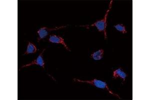 Image no. 6 for anti-Aldehyde Dehydrogenase 1 Family, Member A1 (ALDH1A1) (AA 302-331) antibody (ABIN3029894)