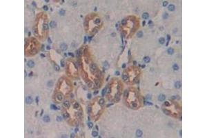 Image no. 2 for anti-Renin (REN) (AA 110-221) antibody (ABIN1173893)