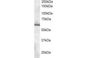 Image no. 2 for anti-Thioredoxin Reductase 1 (TXNRD1) (C-Term) antibody (ABIN184781)