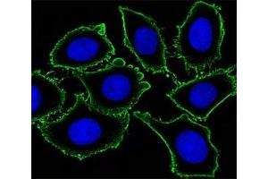Image no. 3 for anti-Mast/stem Cell Growth Factor Receptor (KIT) antibody (ABIN3028783)