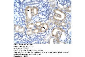 Image no. 2 for anti-T-Box 1 (TBX1) (C-Term) antibody (ABIN2777912)