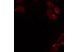 Image no. 1 for anti-UDP-Gal:betaGlcNAc beta 1,3-Galactosyltransferase, Polypeptide 4 (B3GALT4) antibody (ABIN6258541)