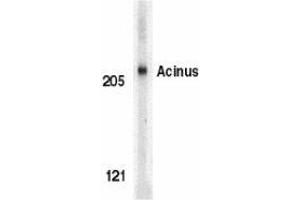 Image no. 2 for anti-Apoptotic Chromatin Condensation Inducer 1 (ACIN1) (Intermediate Domain) antibody (ABIN499201)