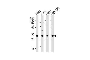 Image no. 1 for anti-Homeobox B2 (HOXB2) (AA 282-306), (C-Term) antibody (ABIN1881427)