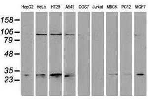 Image no. 4 for anti-Nicotinamide N-Methyltransferase (NNMT) antibody (ABIN1499790)