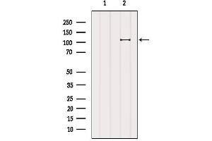 Image no. 4 for anti-BTB and CNC Homology 1, Basic Leucine Zipper Transcription Factor 1 (BACH1) antibody (ABIN6260184)