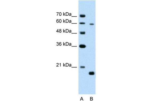 anti-Solute Carrier Family 38 Member 4 (SLC38A4) (Middle Region) antibody
