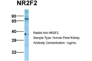 NR2F2 antibody  (N-Term)