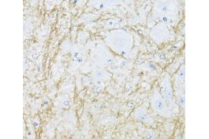 Immunohistochemistry of paraffin-embedded Mouse spinal cord using CNP Polyclonal Antibody at dilution of 1:100 (40x lens).