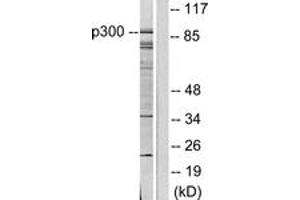 Image no. 2 for anti-K(lysine) Acetyltransferase 2B (KAT2B) (AA 783-832) antibody (ABIN1533368)