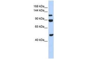 Image no. 1 for anti-N(alpha)-Acetyltransferase 16, NatA Auxiliary Subunit (NAA16) (AA 684-733) antibody (ABIN6743499)