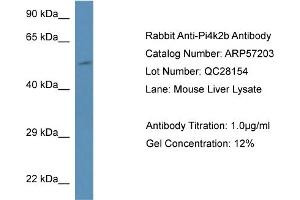 Image no. 1 for anti-Phosphatidylinositol 4-Kinase Type 2 beta (PI4K2B) (N-Term) antibody (ABIN2787116)