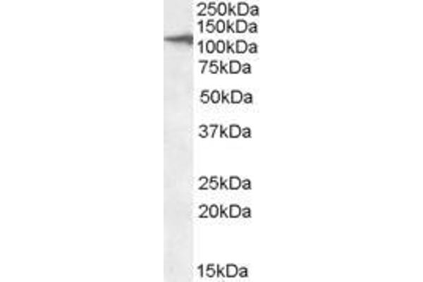 anti-C-Type Lectin Domain Family 16, Member A (CLEC16A) (AA 1040-53) antibody