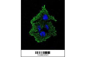 Image no. 1 for anti-Transforming Growth Factor, beta 1 (TGFB1) (AA 30-50) antibody (ABIN656282)