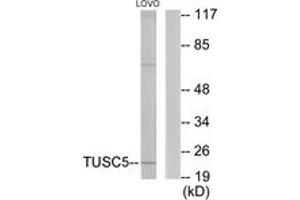 Image no. 2 for anti-Tumor Suppressor Candidate 5 (TUSC5) (AA 1-50) antibody (ABIN1533993)