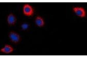 Image no. 2 for anti-Cytochrome P450, Family 2, Subfamily W, Polypeptide 1 (CYP2W1) antibody (ABIN2801450)