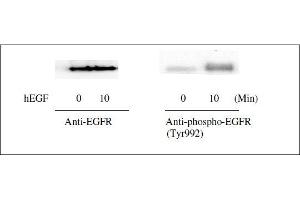 Image no. 9 for Epidermal Growth Factor Receptor (EGFR) ELISA Kit (ABIN1981829)