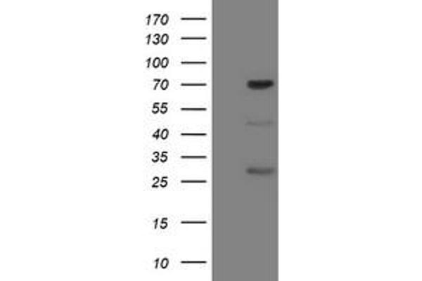 FMR1 抗体  (AA 26-279)